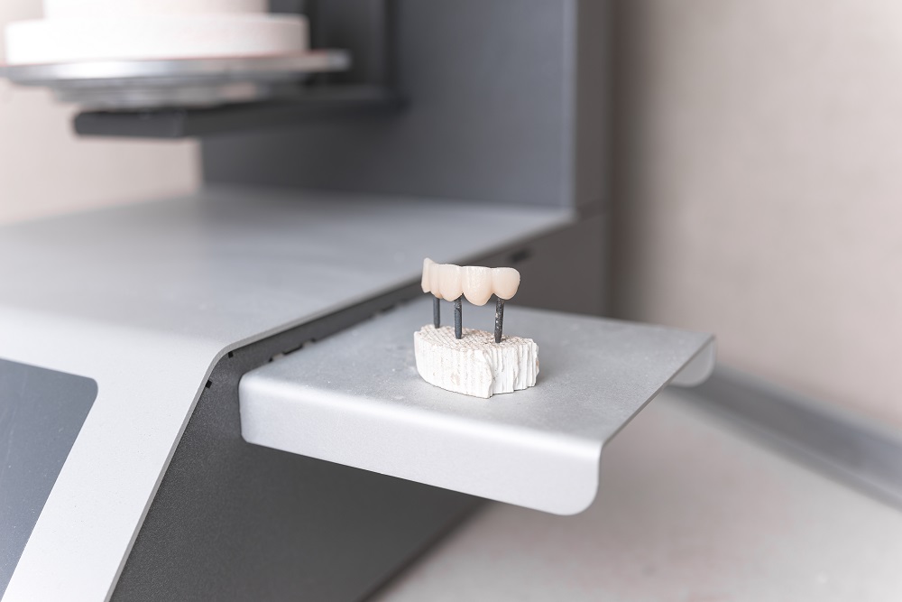 Photo of new ceramic or zirconium teeth ready for implant on the table.